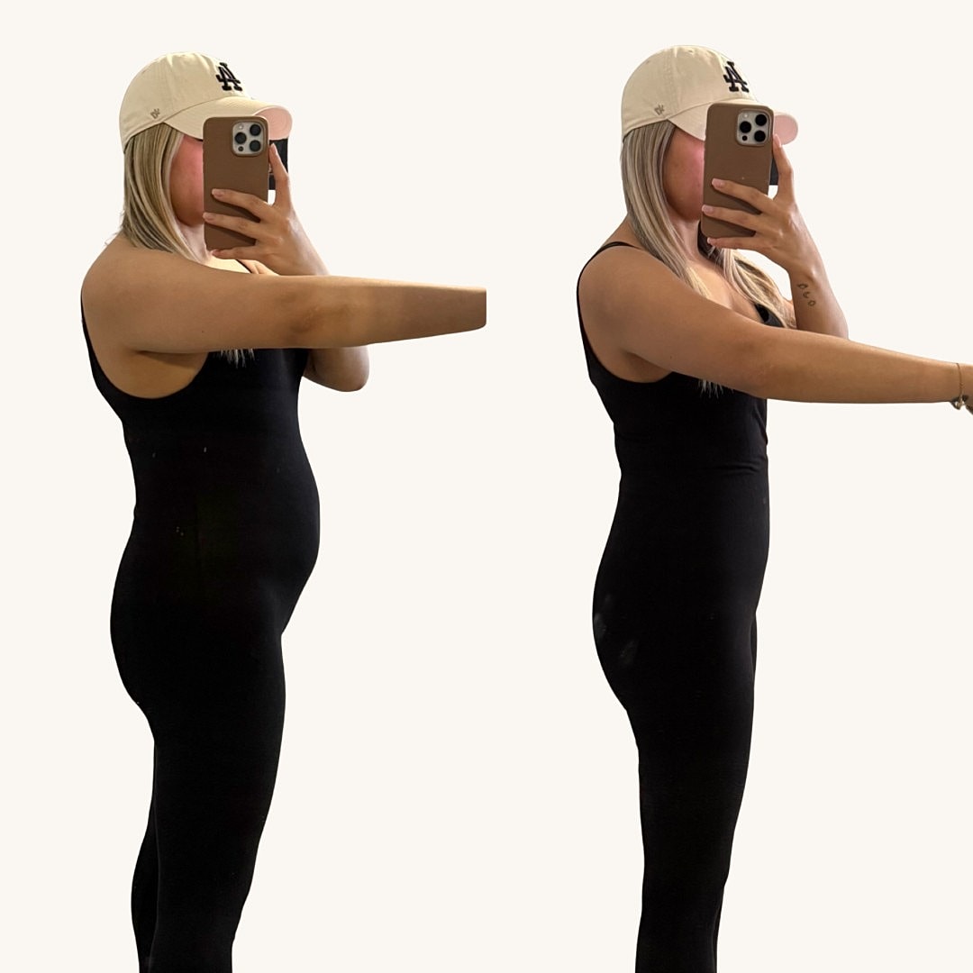 Medical Weight Loss Before & After