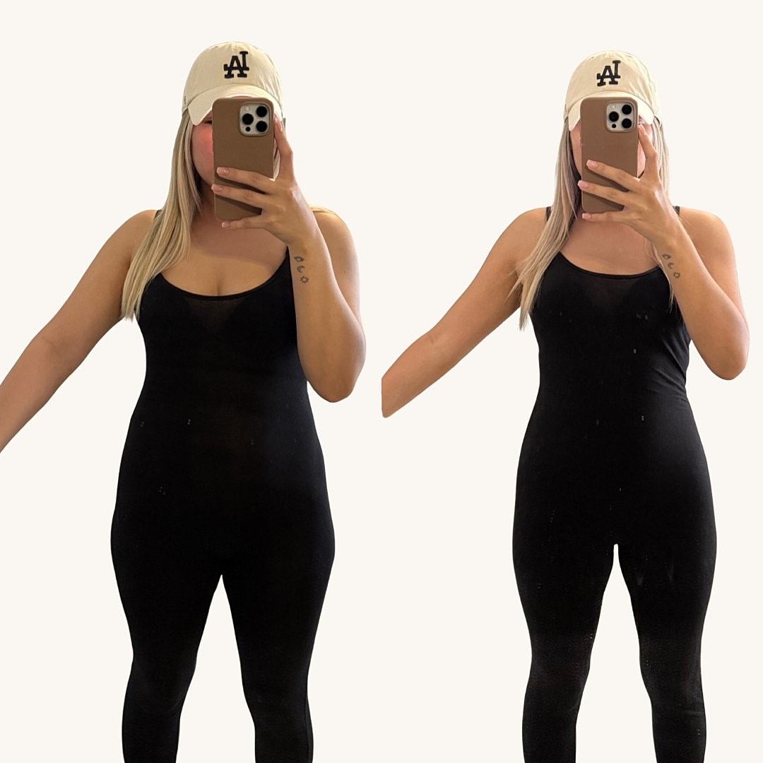 Medical Weight Loss Before & After