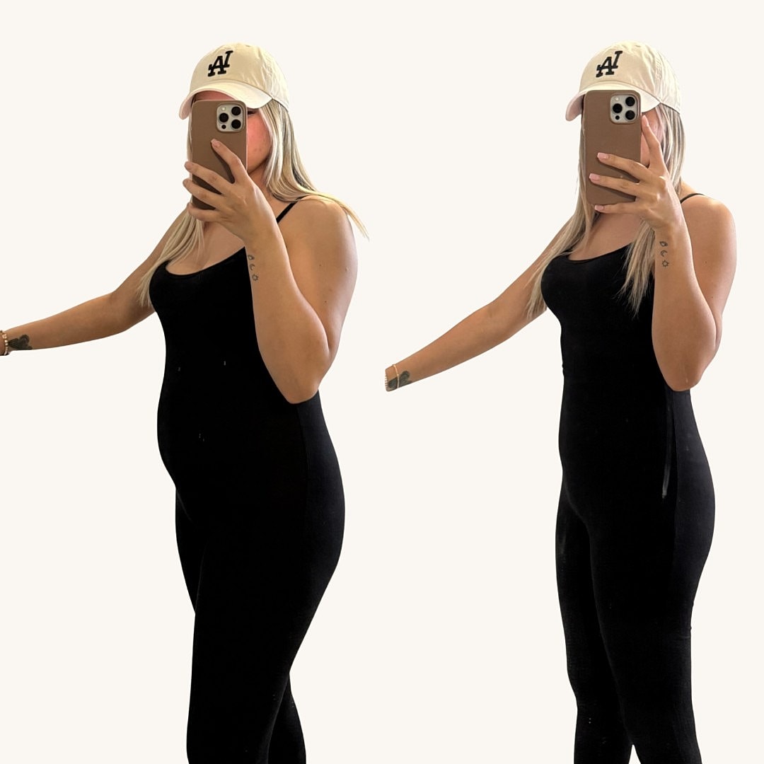 Medical Weight Loss Before & After