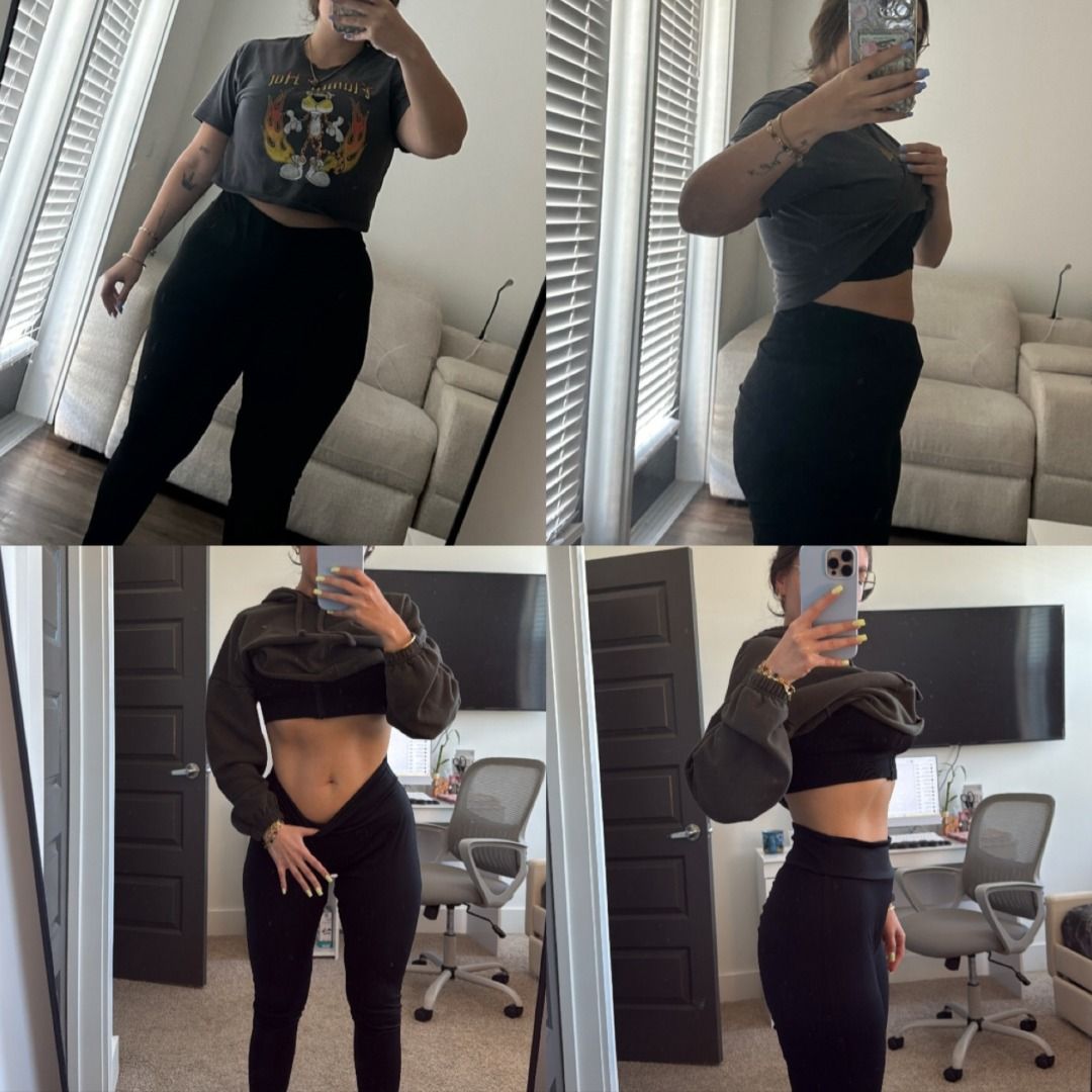 Medical Weight Loss Before & After